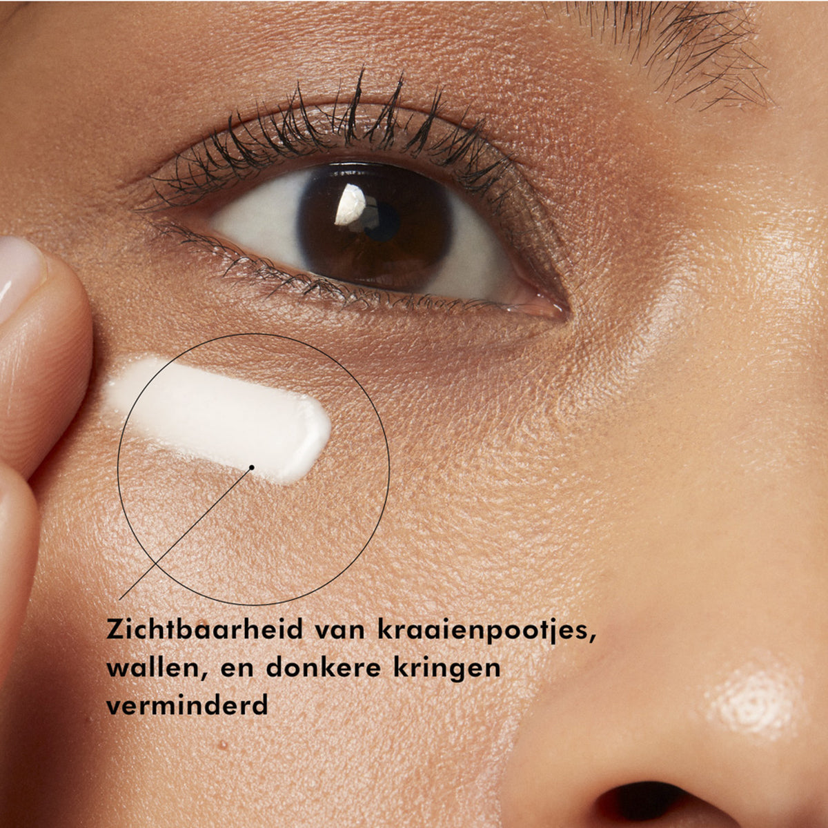 A.G.E. Advanced Eye