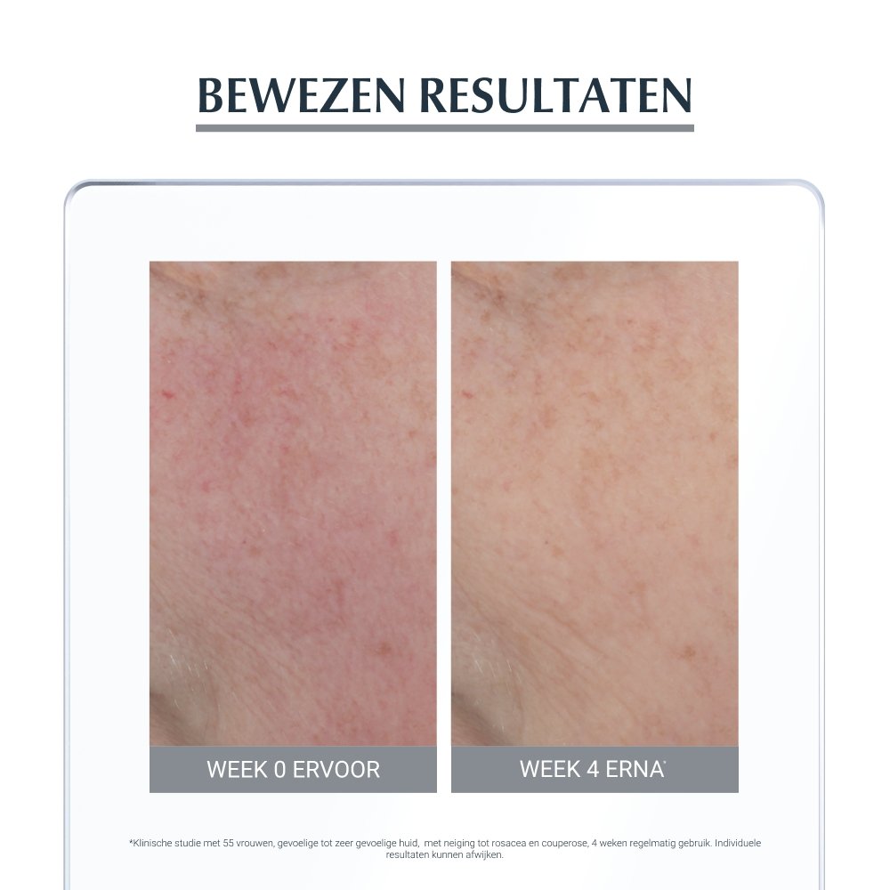 ANTI-REDNESS corrigerende dagcrème SPF25 - MaPeau