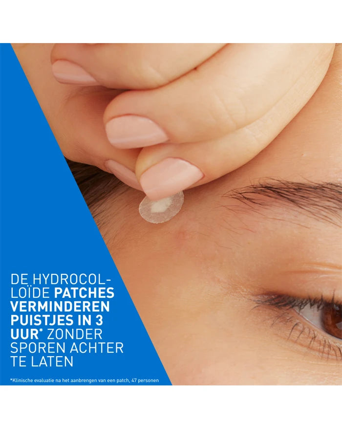 CeraVe Anti-Onzuiverheden Patches