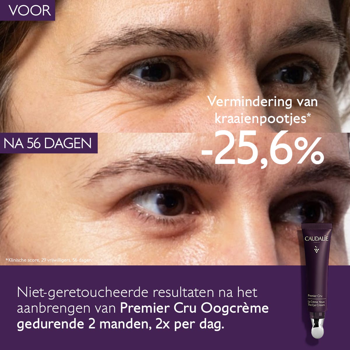De globale anti-aging Oogcrème - MaPeau