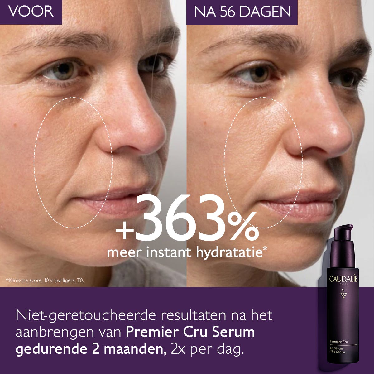 Het globale anti-aging Serum - MaPeau