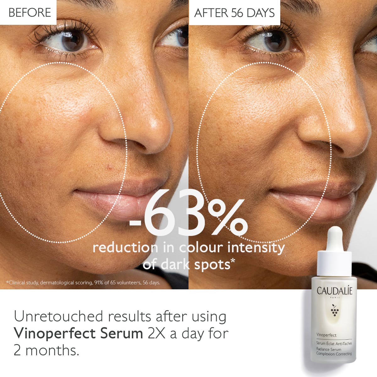 VINOPERFECT Serum Stralende Huid tegen Vlekken - MaPeau