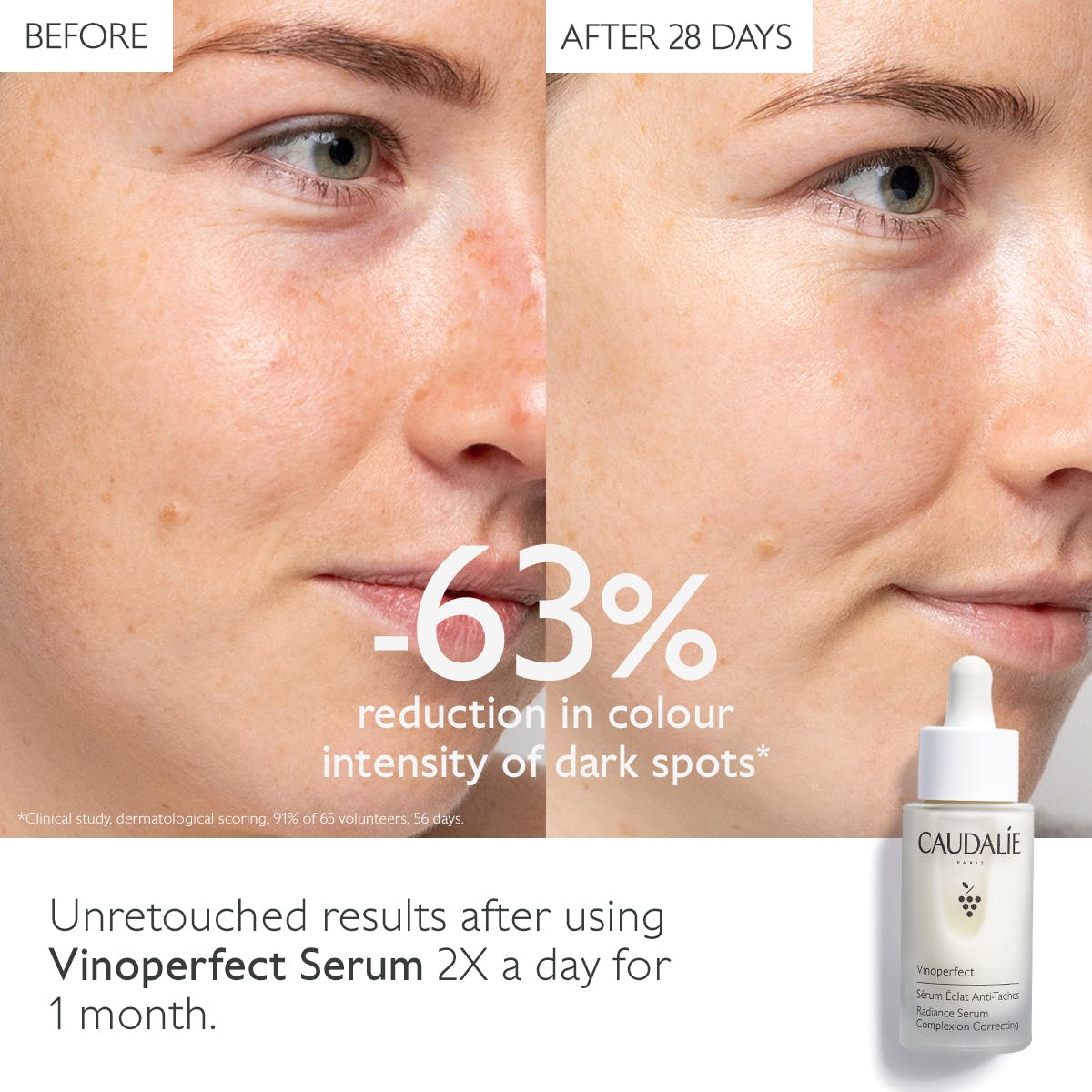 VINOPERFECT Serum Stralende Huid tegen Vlekken - MaPeau