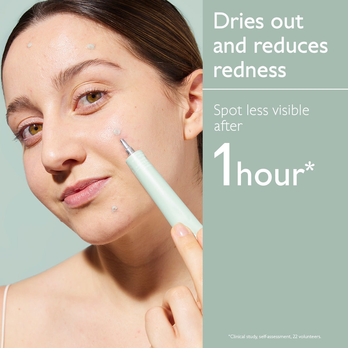 VINOPURE Alicylzuur Spot Treatment - MaPeau