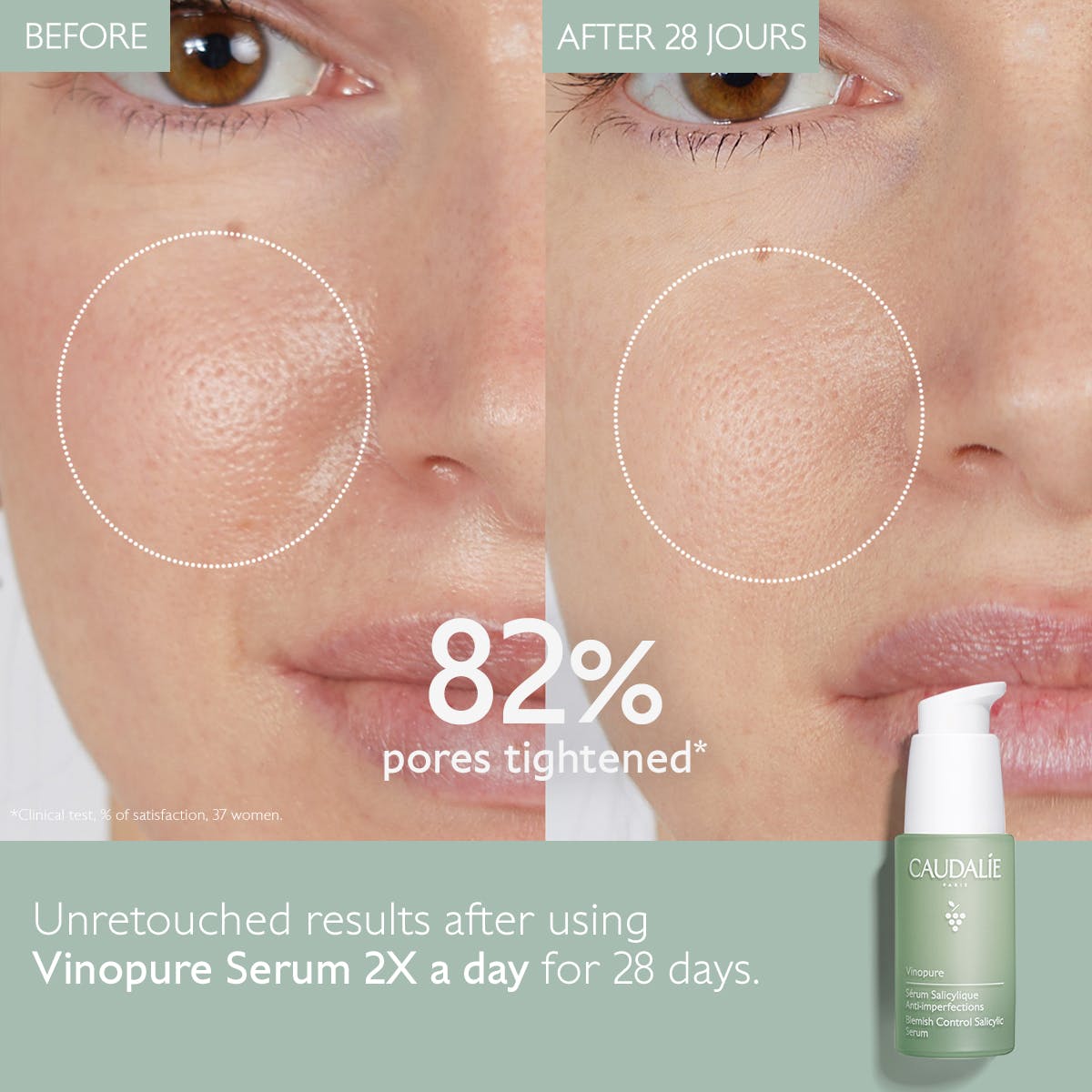 VINOPURE Serum met Salicylzuur tegen Onzuiverheden - MaPeau