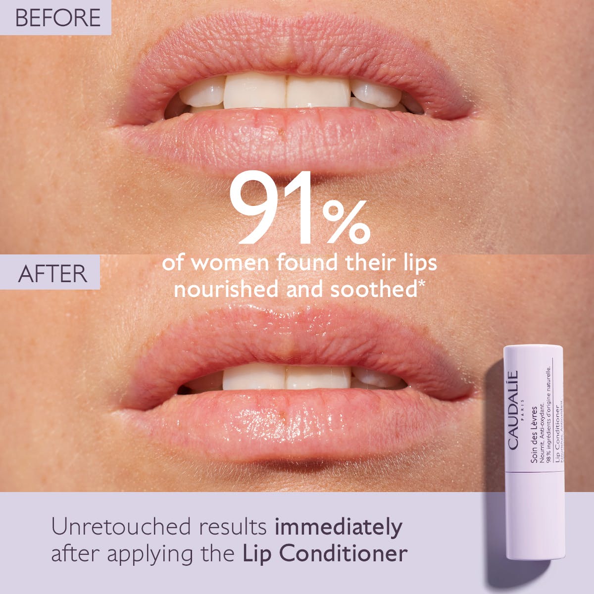 VINOTHERAPIST™ Lippenverzorging - MaPeau